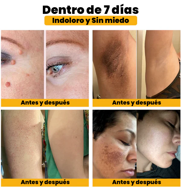 🐝 Paga 1 - Lleva 2🎁 ✨Bee Venom Treatment Cream 🐝