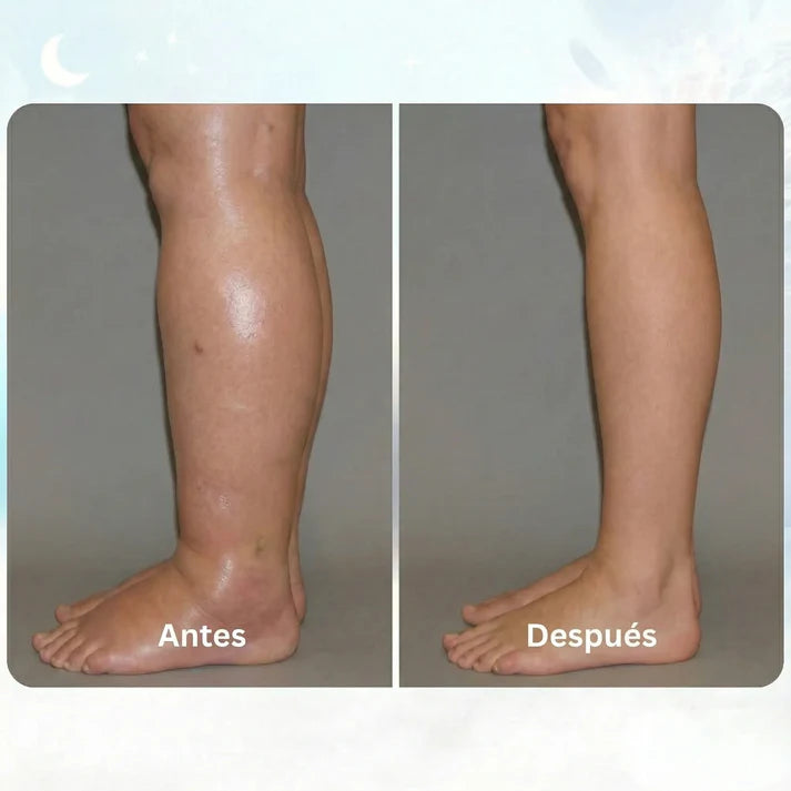 Estimulador EMS para Piernas Hinchadas